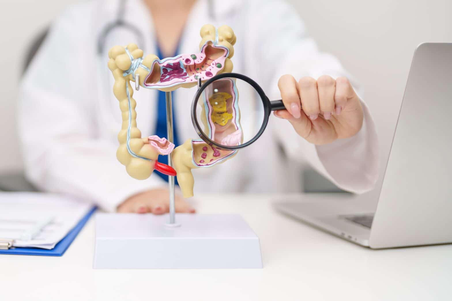 Doctor with human colon anatomy model